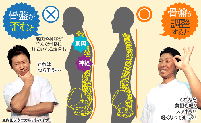 骨盤歪み、調整後比較イメージ